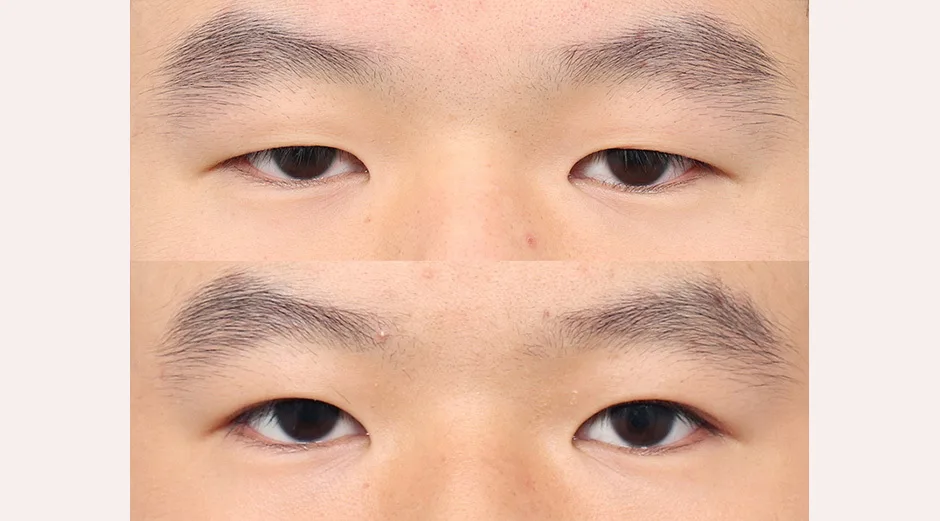 2b1157ac3d0294181a210b1034c3bae2_1742371290_9976.webp