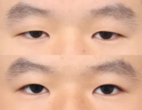 after & before 2